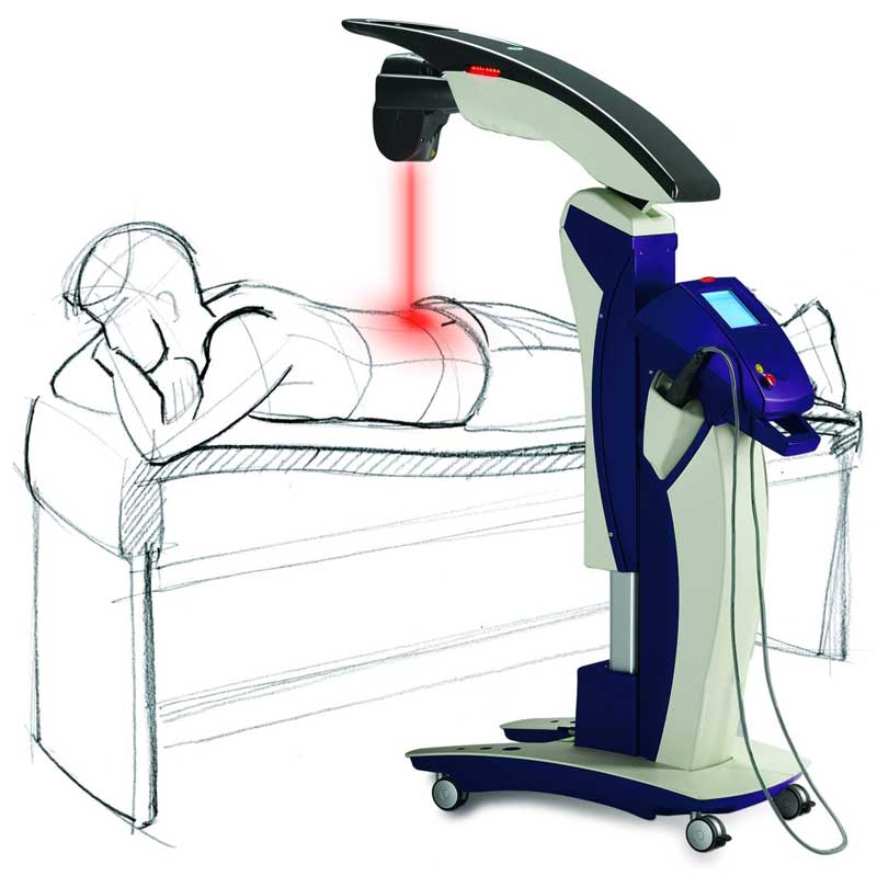 Diagram of robotic laser pain treatment offered in St Pete FL