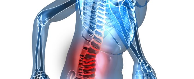 disc herniation treatment st petersburg