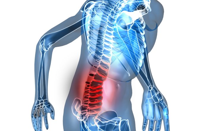 disc herniation treatment st petersburg