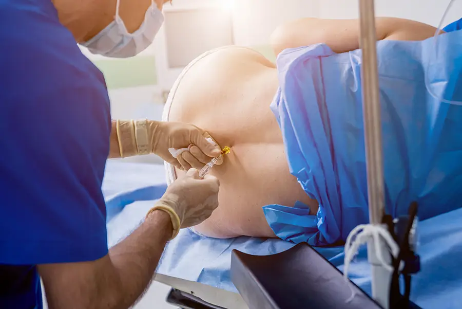 epidural injection A photo of an epidural injection